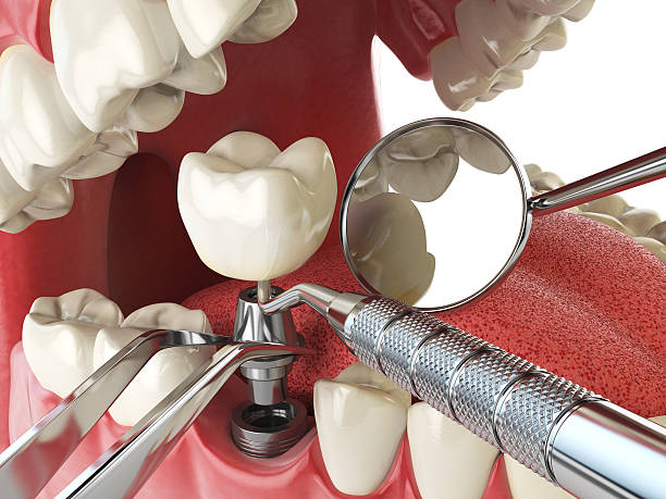 Best Knocked-Out Tooth Emergency  in Norlina, NC